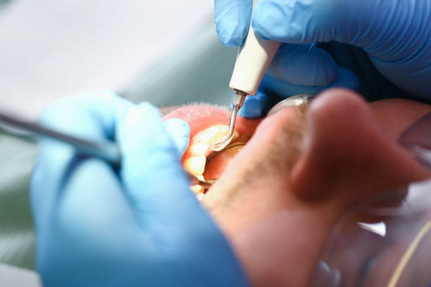 Professional Emergency Dental Service in TX