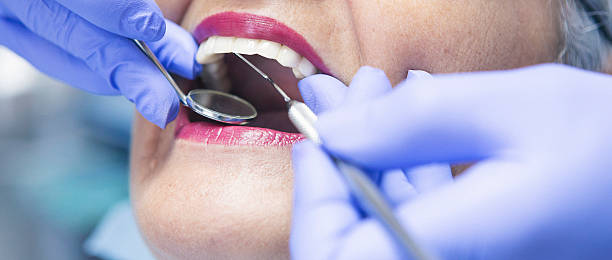 Best Knocked-Out Tooth (Avulsed Tooth) Treatment in Floresville, TX