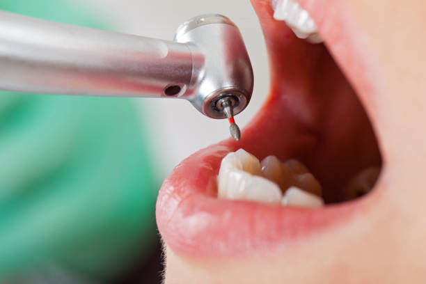 Best Emergency Denture Repair in Floresville, TX